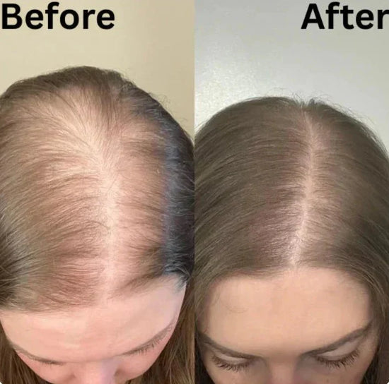 Noriva™ Rosemary Growth Shampoo